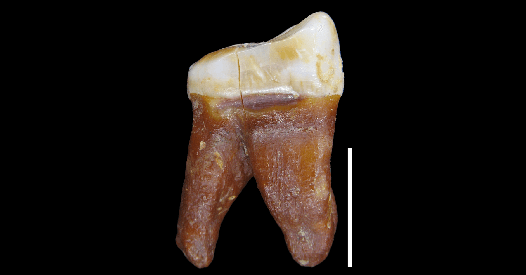 Zahn eines Neanderthalers mit Zahnstocherspur